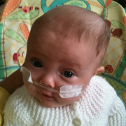 Baby Ebony at home with oxygen apparatus.